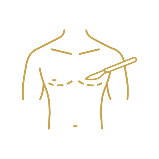 Gynecomastia
